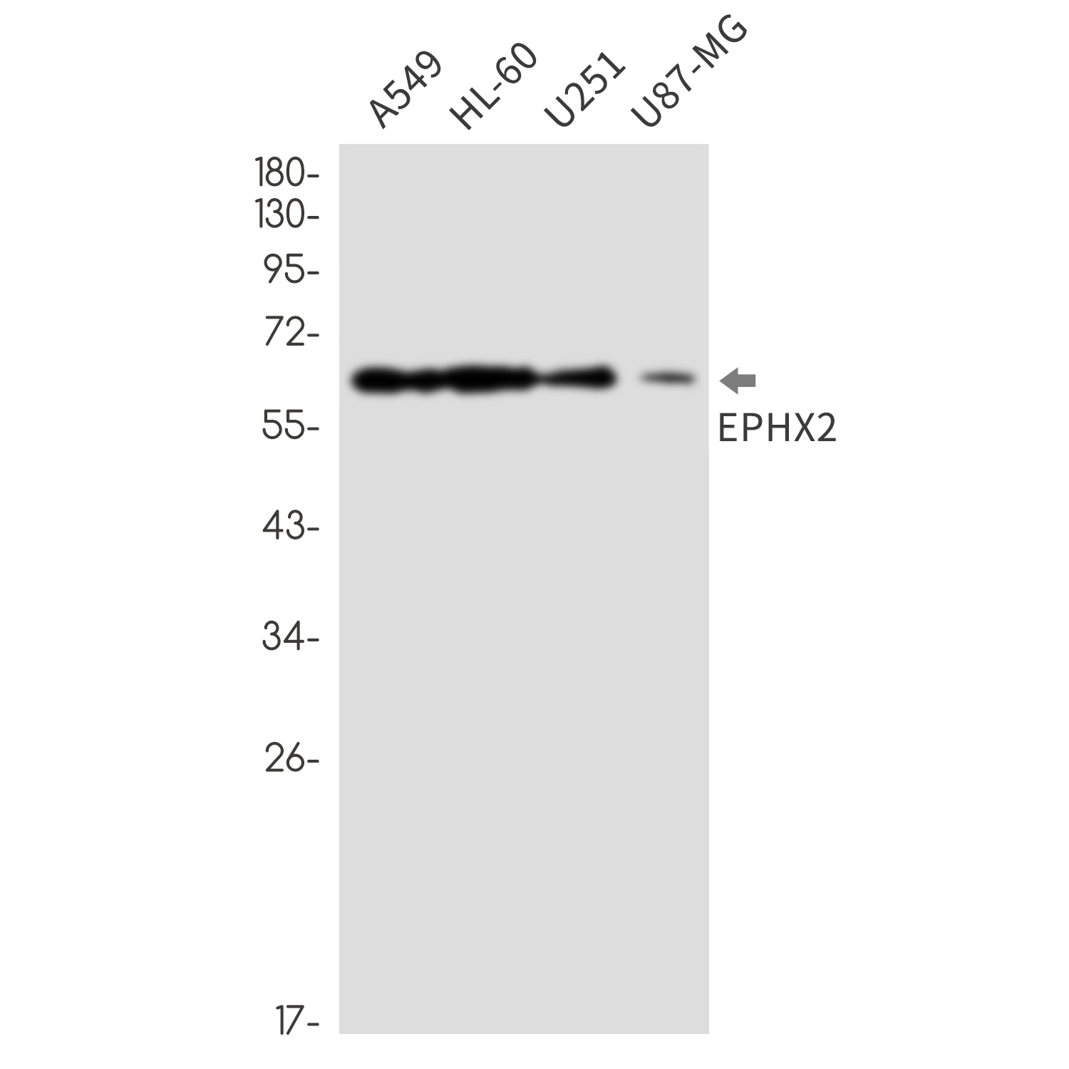 Epoxide Hydrolase 1 Rabbit mAb